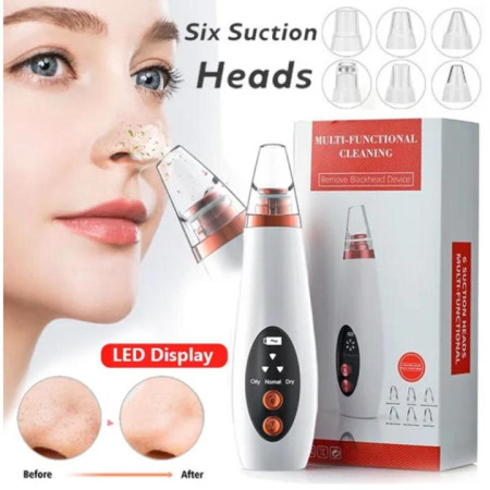 Black Head Remover Device